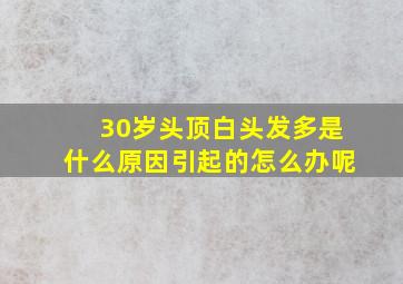 30岁头顶白头发多是什么原因引起的怎么办呢