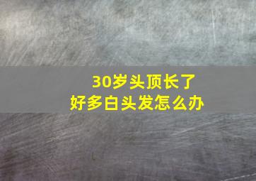 30岁头顶长了好多白头发怎么办