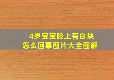 4岁宝宝脸上有白块怎么回事图片大全图解