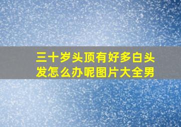 三十岁头顶有好多白头发怎么办呢图片大全男