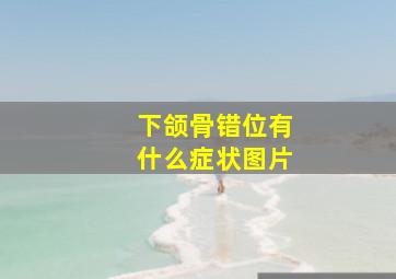 下颌骨错位有什么症状图片