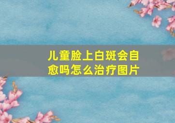 儿童脸上白斑会自愈吗怎么治疗图片