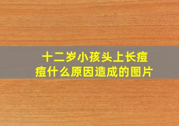 十二岁小孩头上长痘痘什么原因造成的图片