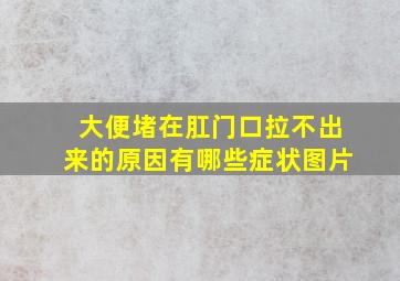 大便堵在肛门口拉不出来的原因有哪些症状图片