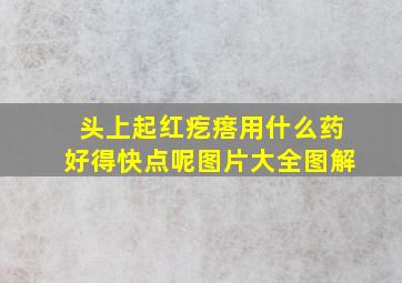 头上起红疙瘩用什么药好得快点呢图片大全图解