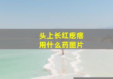 头上长红疙瘩用什么药图片