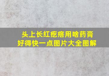 头上长红疙瘩用啥药膏好得快一点图片大全图解