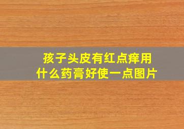 孩子头皮有红点痒用什么药膏好使一点图片