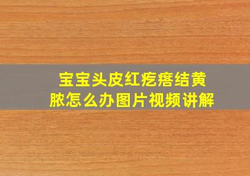 宝宝头皮红疙瘩结黄脓怎么办图片视频讲解