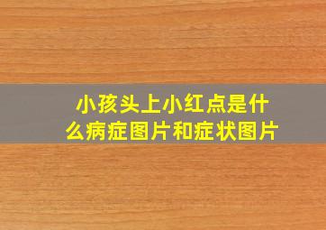 小孩头上小红点是什么病症图片和症状图片