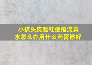 小孩头皮起红疙瘩流黄水怎么办用什么药膏擦好