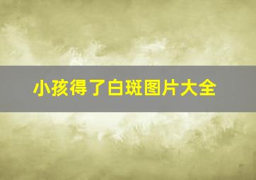 小孩得了白斑图片大全