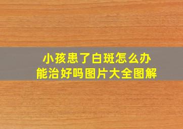 小孩患了白斑怎么办能治好吗图片大全图解