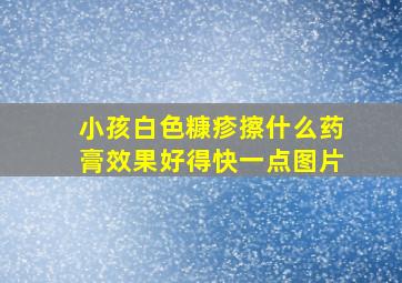 小孩白色糠疹擦什么药膏效果好得快一点图片