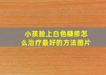 小孩脸上白色糠疹怎么治疗最好的方法图片