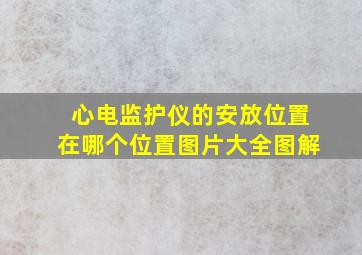 心电监护仪的安放位置在哪个位置图片大全图解