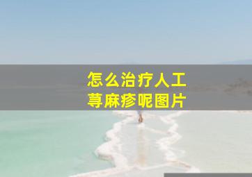 怎么治疗人工荨麻疹呢图片