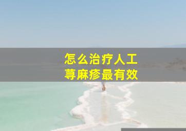 怎么治疗人工荨麻疹最有效