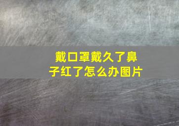 戴口罩戴久了鼻子红了怎么办图片