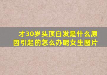 才30岁头顶白发是什么原因引起的怎么办呢女生图片