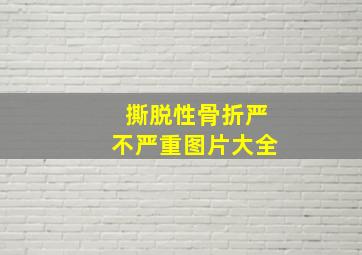 撕脱性骨折严不严重图片大全