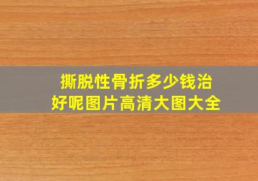 撕脱性骨折多少钱治好呢图片高清大图大全