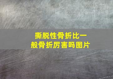 撕脱性骨折比一般骨折厉害吗图片