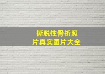 撕脱性骨折照片真实图片大全