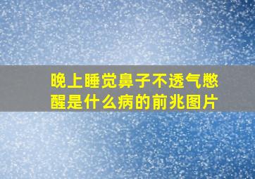 晚上睡觉鼻子不透气憋醒是什么病的前兆图片