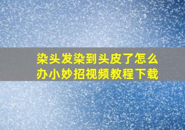 染头发染到头皮了怎么办小妙招视频教程下载