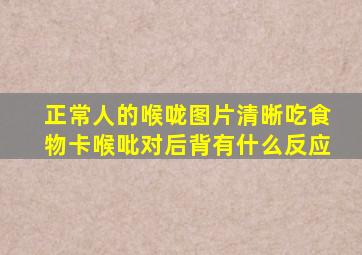 正常人的喉咙图片清晰吃食物卡喉吡对后背有什么反应