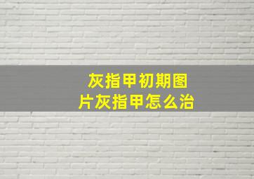 灰指甲初期图片灰指甲怎么治