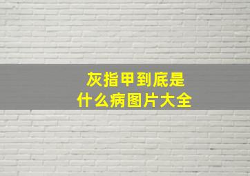 灰指甲到底是什么病图片大全