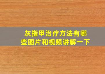 灰指甲治疗方法有哪些图片和视频讲解一下