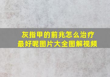 灰指甲的前兆怎么治疗最好呢图片大全图解视频