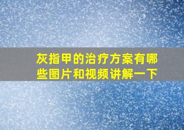 灰指甲的治疗方案有哪些图片和视频讲解一下