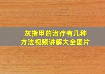 灰指甲的治疗有几种方法视频讲解大全图片