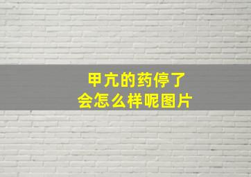 甲亢的药停了会怎么样呢图片