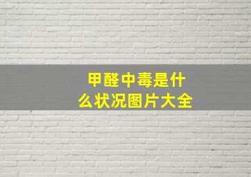 甲醛中毒是什么状况图片大全