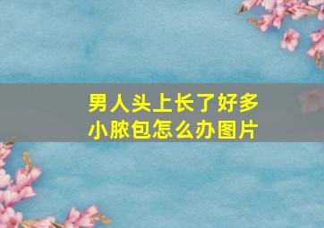 男人头上长了好多小脓包怎么办图片