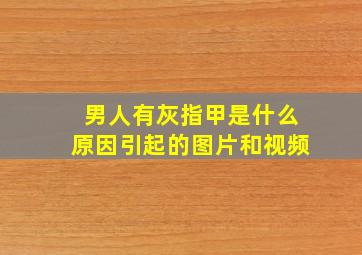 男人有灰指甲是什么原因引起的图片和视频