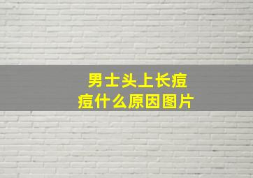 男士头上长痘痘什么原因图片