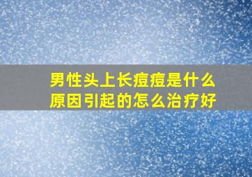 男性头上长痘痘是什么原因引起的怎么治疗好