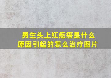 男生头上红疙瘩是什么原因引起的怎么治疗图片