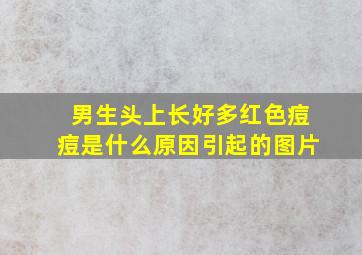 男生头上长好多红色痘痘是什么原因引起的图片