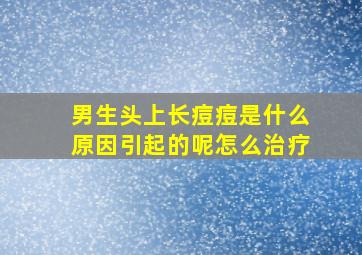 男生头上长痘痘是什么原因引起的呢怎么治疗