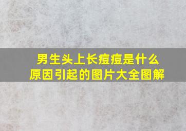 男生头上长痘痘是什么原因引起的图片大全图解