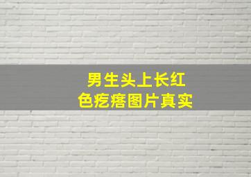 男生头上长红色疙瘩图片真实