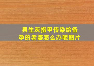 男生灰指甲传染给备孕的老婆怎么办呢图片