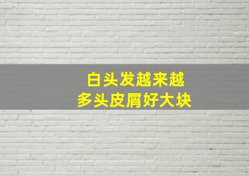 白头发越来越多头皮屑好大块